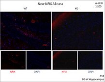Anti-NFIX antibody produced in rabbit affinity isolated antibody