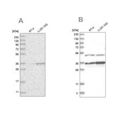 Anti-PDHB antibody produced in rabbit Prestige Antibodies&#174; Powered by Atlas Antibodies, affinity isolated antibody, buffered aqueous glycerol solution