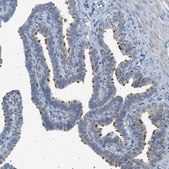 Anti-TTBK2 antibody produced in rabbit Prestige Antibodies&#174; Powered by Atlas Antibodies, affinity isolated antibody, buffered aqueous glycerol solution