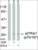 Anti-phospho-CDKN1B (pThr187) antibody produced in rabbit affinity isolated antibody