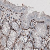 Monoclonal Anti-LAMC1 antibody produced in mouse Prestige Antibodies&#174; Powered by Atlas Antibodies, clone CL3196, purified immunoglobulin, buffered aqueous glycerol solution