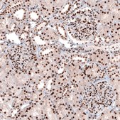 Monoclonal Anti-CUX1 antibody produced in mouse Prestige Antibodies&#174; Powered by Atlas Antibodies, clone CL5278, purified immunoglobulin, buffered aqueous glycerol solution