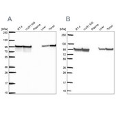 Anti-HSP90AB1 antibody produced in rabbit Prestige Antibodies&#174; Powered by Atlas Antibodies, affinity isolated antibody