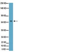 Anti-Tau Antibody, a.a. 210-241, clone Tau-5 ascites fluid, clone Tau-5, Chemicon&#174;
