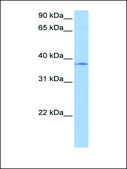 Anti-SPRY2 antibody produced in rabbit affinity isolated antibody