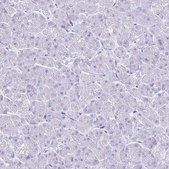 Anti-TIMP1 antibody produced in rabbit Prestige Antibodies&#174; Powered by Atlas Antibodies, affinity isolated antibody, buffered aqueous glycerol solution