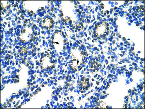 Anti-PCBP2 (AB1) antibody produced in rabbit IgG fraction of antiserum