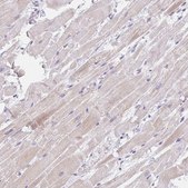 Anti-CACNA1S antibody produced in rabbit Prestige Antibodies&#174; Powered by Atlas Antibodies, affinity isolated antibody, buffered aqueous glycerol solution