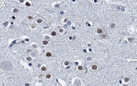 Anti-MEF2C Antibody, clone 1D21 ZooMAb&#174; Rabbit Monoclonal recombinant, expressed in HEK 293 cells