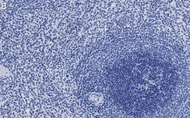 Anti-MEK2 Antibody, clone 1J7 ZooMAb&#174; Rabbit Monoclonal recombinant, expressed in HEK 293 cells