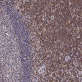 Anti-GRAP2 antibody produced in rabbit Prestige Antibodies&#174; Powered by Atlas Antibodies, affinity isolated antibody, buffered aqueous glycerol solution