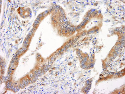Rabbit anti-PML Antibody, Affinity Purified Powered by Bethyl Laboratories, Inc.