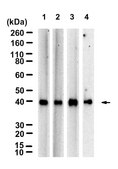Anti-HLA-B Antibody, clone 1L21 ZooMAb&#174; Rabbit Monoclonal recombinant, expressed in HEK 293 cells