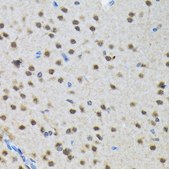 Anti-SMN1 Antibody, clone 9N9Q6, Rabbit Monoclonal