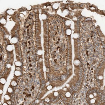 Anti-SDCCAG3 antibody produced in rabbit Prestige Antibodies&#174; Powered by Atlas Antibodies, affinity isolated antibody, buffered aqueous glycerol solution