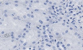 Anti-COX2 Antibody, clone 2B19 ZooMAb® Rabbit Monoclonal recombinant, expressed in HEK 293 cells