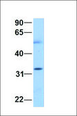 Anti-SMN1 antibody produced in rabbit affinity isolated antibody