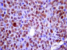 Anti-phospho-BRCA2 (Ser3291) Antibody from rabbit, purified by affinity chromatography