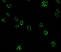 Monoclonal Anti-Splicing Factor SC-35 antibody produced in mouse clone SC-35, ascites fluid