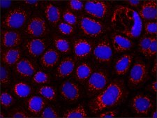 Anti-APC (C-terminal) antibody produced in rabbit ~1.0 mg/mL, affinity isolated antibody
