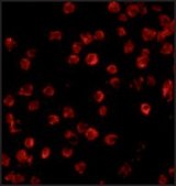 Anti-BTK antibody produced in rabbit affinity isolated antibody, buffered aqueous solution