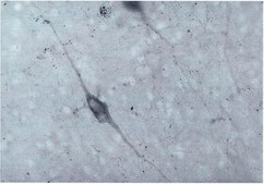 Anti-Dopamine &#946; Hydroxylase Antibody serum, Chemicon&#174;