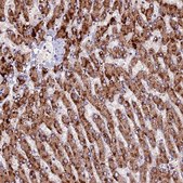 Anti-ZNF598 antibody produced in rabbit Prestige Antibodies&#174; Powered by Atlas Antibodies, affinity isolated antibody, buffered aqueous glycerol solution