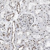 Anti-HNRNPH2 antibody produced in rabbit Prestige Antibodies&#174; Powered by Atlas Antibodies, affinity isolated antibody, buffered aqueous glycerol solution