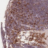 Anti-CD33 antibody produced in rabbit Prestige Antibodies&#174; Powered by Atlas Antibodies, affinity isolated antibody, buffered aqueous glycerol solution