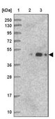 Anti-ARMC6 antibody produced in rabbit Prestige Antibodies&#174; Powered by Atlas Antibodies, affinity isolated antibody, buffered aqueous glycerol solution