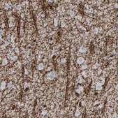 Anti-CNP antibody produced in rabbit Prestige Antibodies&#174; Powered by Atlas Antibodies, affinity isolated antibody, buffered aqueous glycerol solution, Ab1