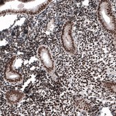 Monoclonal Anti-METTL14 antibody produced in mouse Prestige Antibodies&#174; Powered by Atlas Antibodies, clone CL4252, purified immunoglobulin