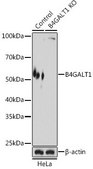 Anti- B4GALT1 antibody produced in rabbit