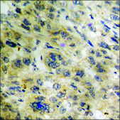 Anti-phospho-p70 S6 Kinase (pThr421) antibody produced in rabbit affinity isolated antibody