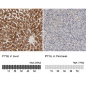Anti-PYGL antibody produced in rabbit Prestige Antibodies&#174; Powered by Atlas Antibodies, affinity isolated antibody, buffered aqueous glycerol solution