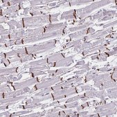 Anti-RAB9B antibody produced in rabbit Prestige Antibodies&#174; Powered by Atlas Antibodies, affinity isolated antibody, buffered aqueous glycerol solution