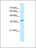 Anti-TPM1 IgG fraction of antiserum
