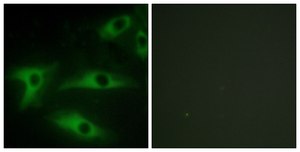 Anti-Collagen I &#945;2 antibody produced in rabbit affinity isolated antibody
