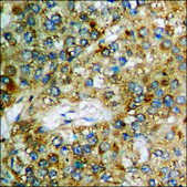 Anti-phospho-NF-kappaB p65 (pSer468) antibody produced in rabbit affinity isolated antibody