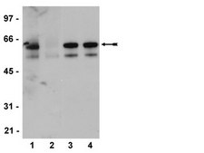 Anti-phospho-Src family (Tyr416) Antibody, clone 2N8, rabbit monoclonal culture supernatant, clone 2N8, Upstate&#174;