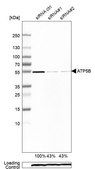 Anti-ATP5B antibody produced in rabbit Ab2, Prestige Antibodies&#174; Powered by Atlas Antibodies, affinity isolated antibody, buffered aqueous glycerol solution