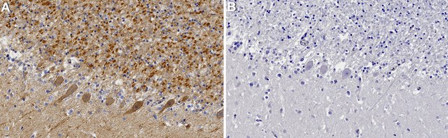 Anti-Neuroligin-2 Antibody, clone 2H2 ZooMAb&#174; Rabbit Monoclonal recombinant, expressed in HEK 293 cells