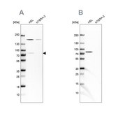 Anti-BTK antibody produced in rabbit Ab2, Prestige Antibodies&#174; Powered by Atlas Antibodies, affinity isolated antibody, buffered aqueous glycerol solution