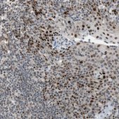 Anti-FBXO44 antibody produced in rabbit Prestige Antibodies&#174; Powered by Atlas Antibodies, affinity isolated antibody, buffered aqueous glycerol solution