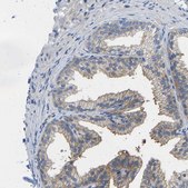 Anti-PPP3CA antibody produced in rabbit Prestige Antibodies&#174; Powered by Atlas Antibodies, affinity isolated antibody, buffered aqueous glycerol solution