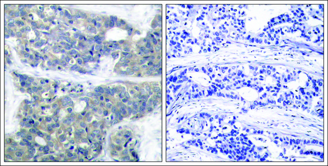 Anti-phospho-RPS6KB1 (pThr421) antibody produced in rabbit affinity isolated antibody