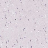 Anti-CMA1 antibody produced in rabbit Prestige Antibodies&#174; Powered by Atlas Antibodies, affinity isolated antibody, buffered aqueous glycerol solution