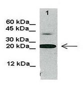 Anti-CTSD antibody produced in rabbit affinity isolated antibody