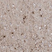 Anti-MCAT antibody produced in rabbit Prestige Antibodies&#174; Powered by Atlas Antibodies, affinity isolated antibody, buffered aqueous glycerol solution