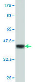 Monoclonal Anti-RBBP6 antibody produced in mouse clone 5A11, purified immunoglobulin, buffered aqueous solution